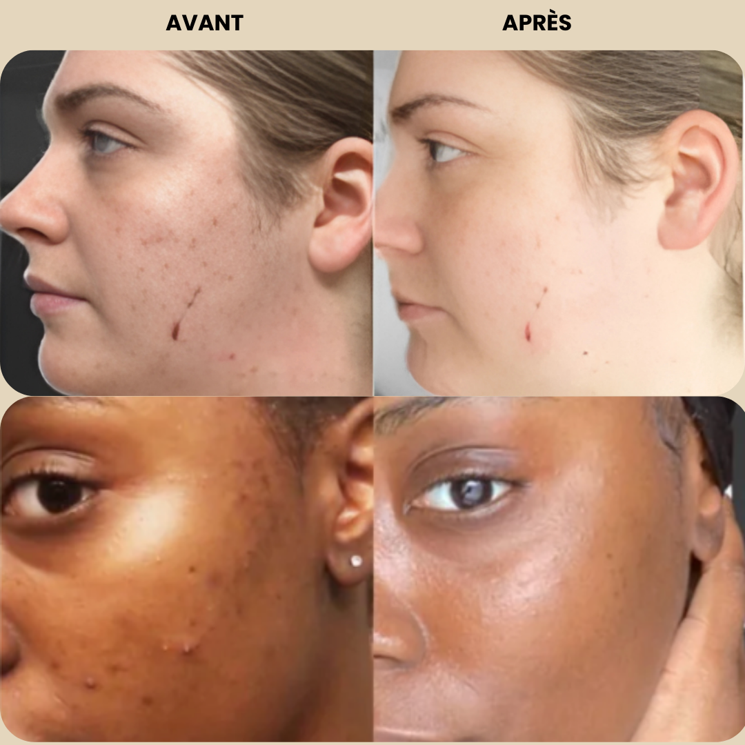 Pads CuraClean™