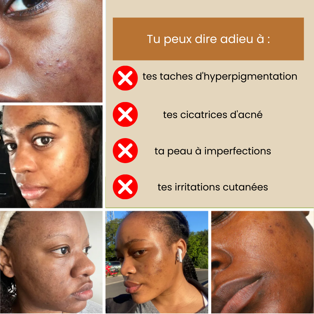 Pads CuraClean™